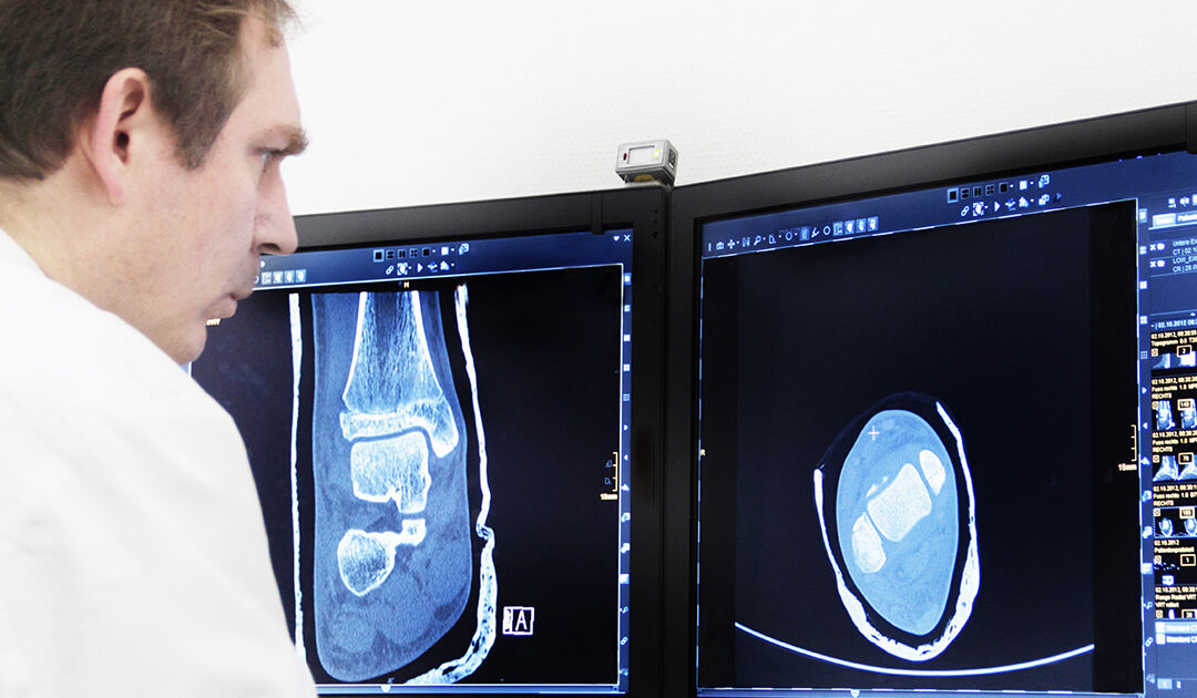 How AI is helping manage radiology’s data deluge